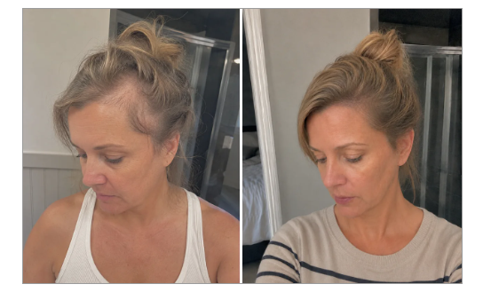 Bathroom before photo of a woman comparing her hair routine