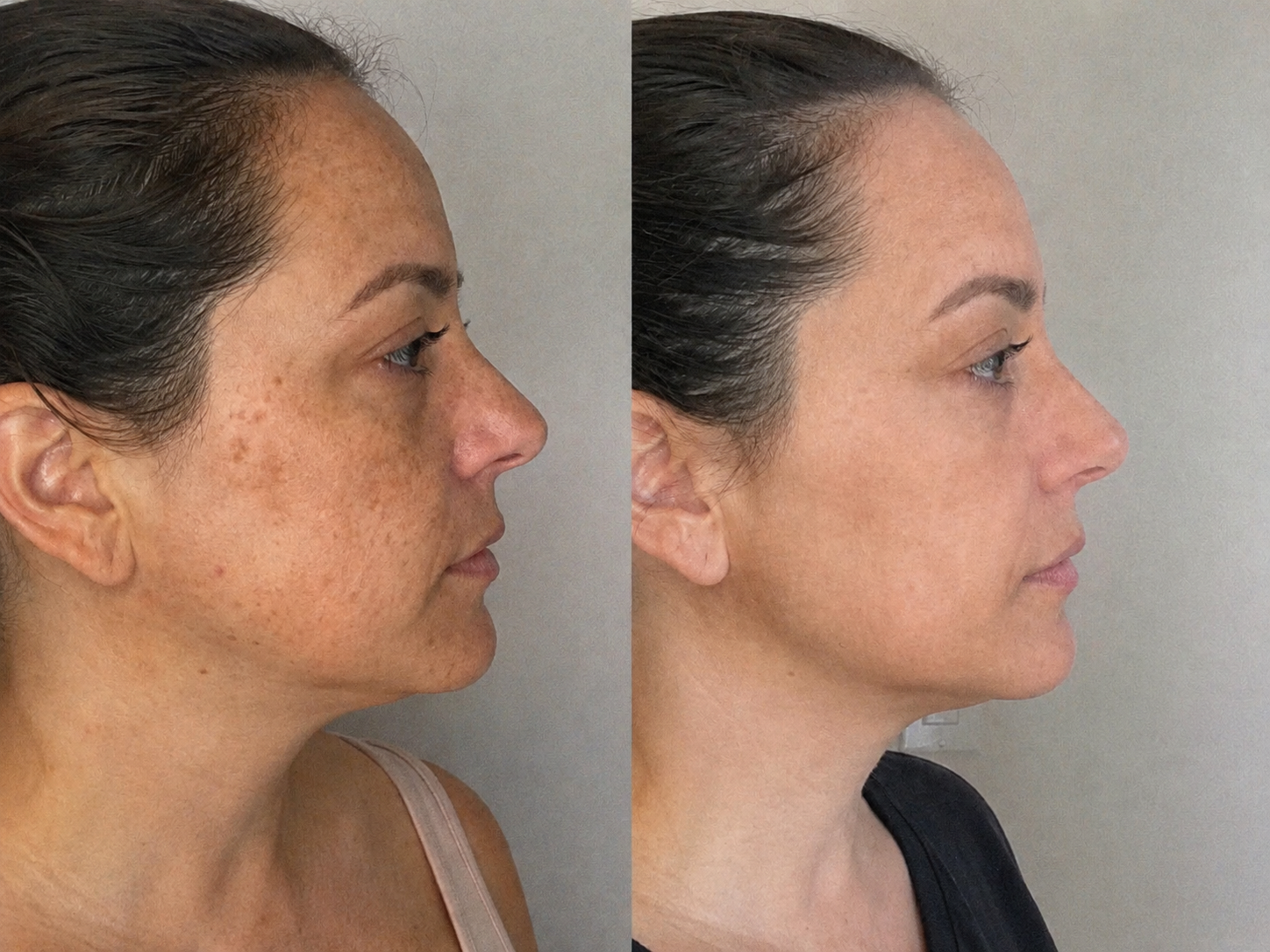Side-by-side profile photos from a beauty routine comparison